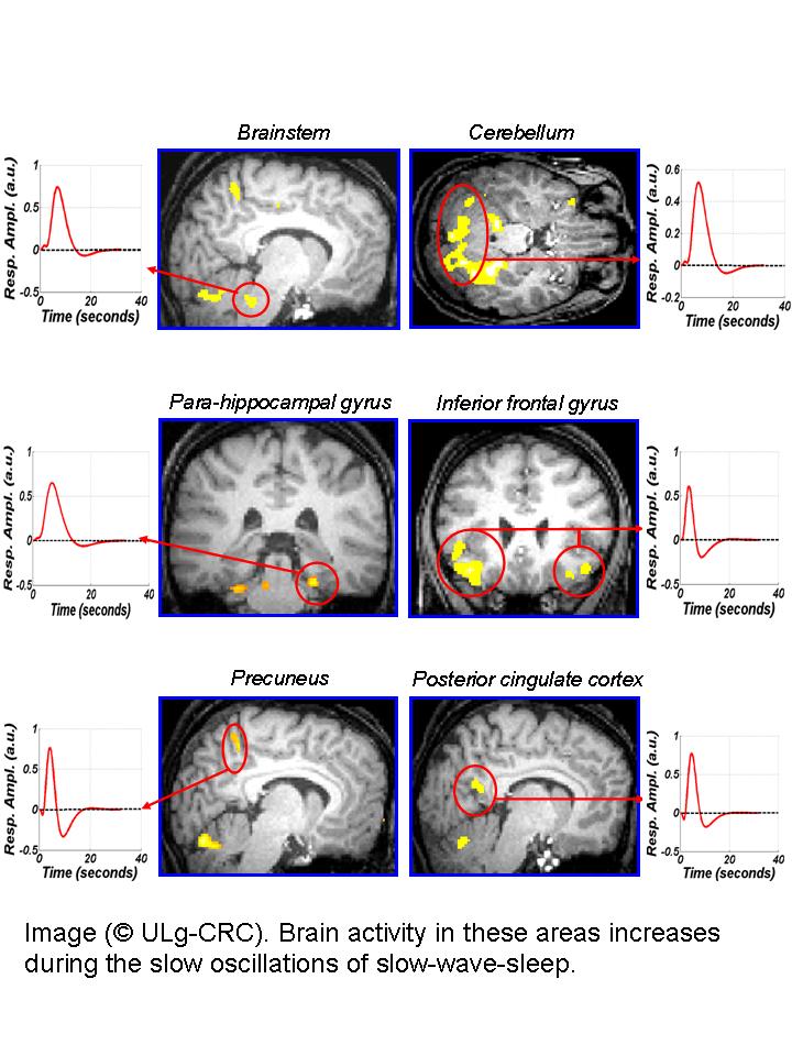 Actividad cerebral y sueño: un estudio revelador