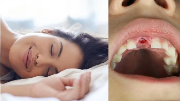 ¡Alerta! ¿Dientes flojos y cayéndose en tus sueños? Descubre su significado aquí