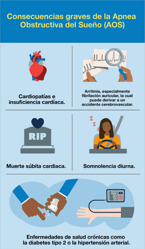 Apnea del sueño: mortalidad y complicaciones