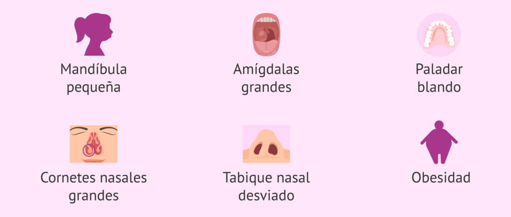 Apnea del sueño por obesidad: costos y consecuencias