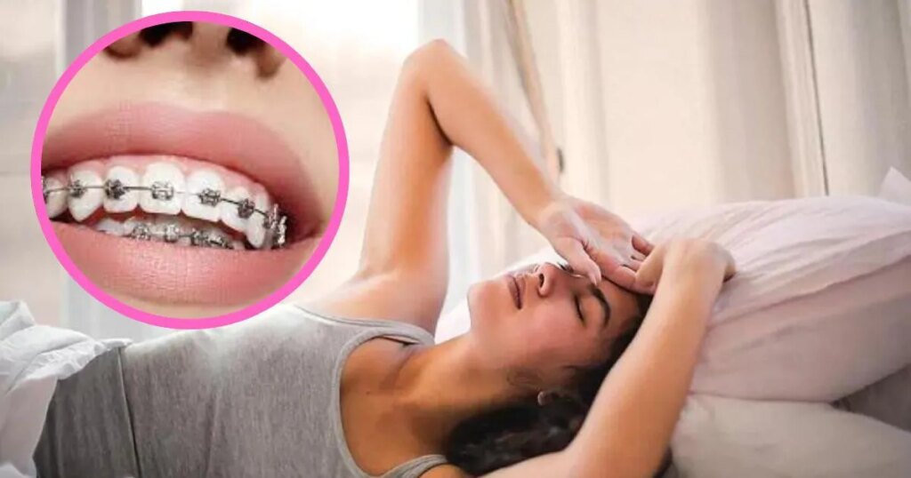 ¿Brackets cayéndose en sueños? Descubre su interpretación aquí