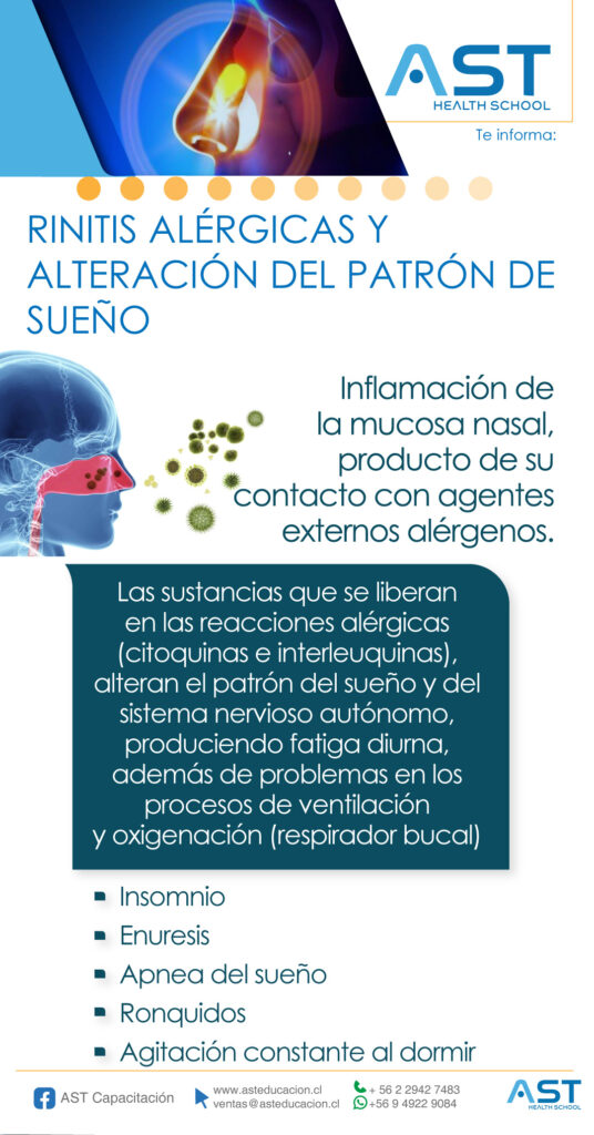 Combate el sueño obstructor causado por rinitis alérgica y asma