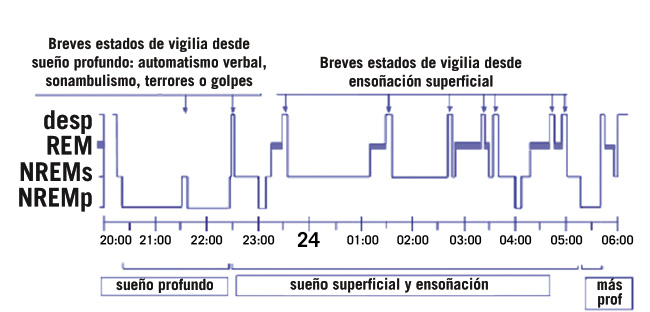 Comparativa hipnograma: persona sana vs trastorno del sueño