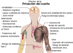 Consecuencias de la privación de sueño en el cuerpo humano