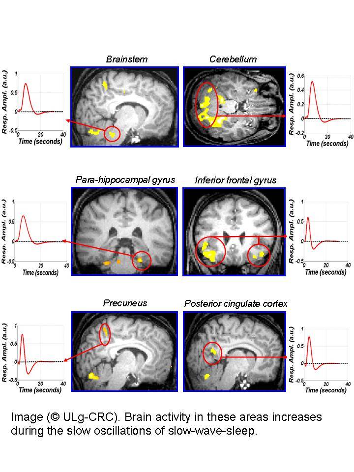 Descubre cómo funciona tu cerebro cuando te da sueño