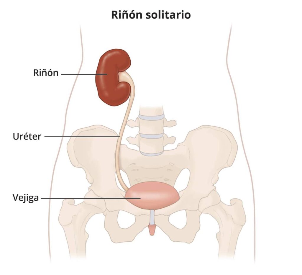 Descubre el significado de soñar con extirparse un riñón en solitario