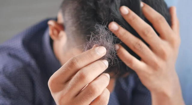 Descubre el significado detrás de soñar con caída de cabello