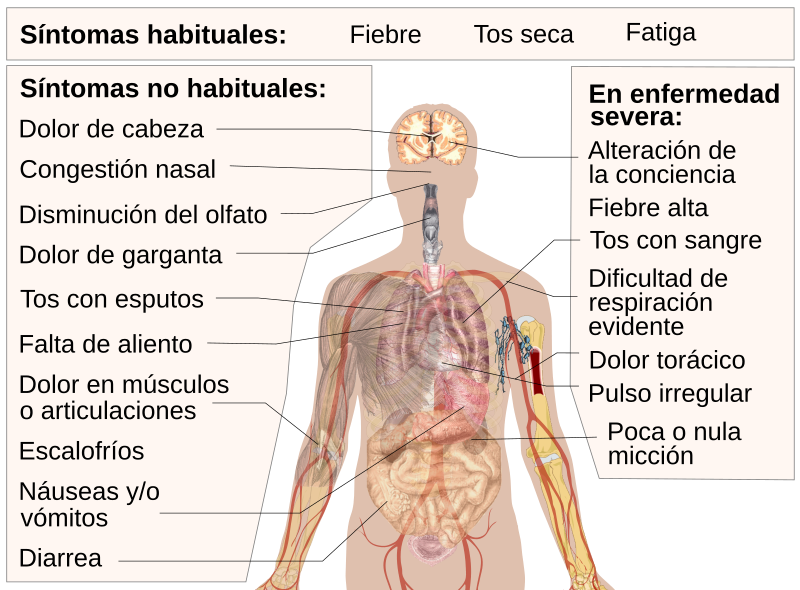 Descubre las causas de tus malestares: síntomas de enfermedad