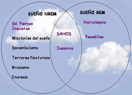 Descubre las causas del trastorno del sueño no REM