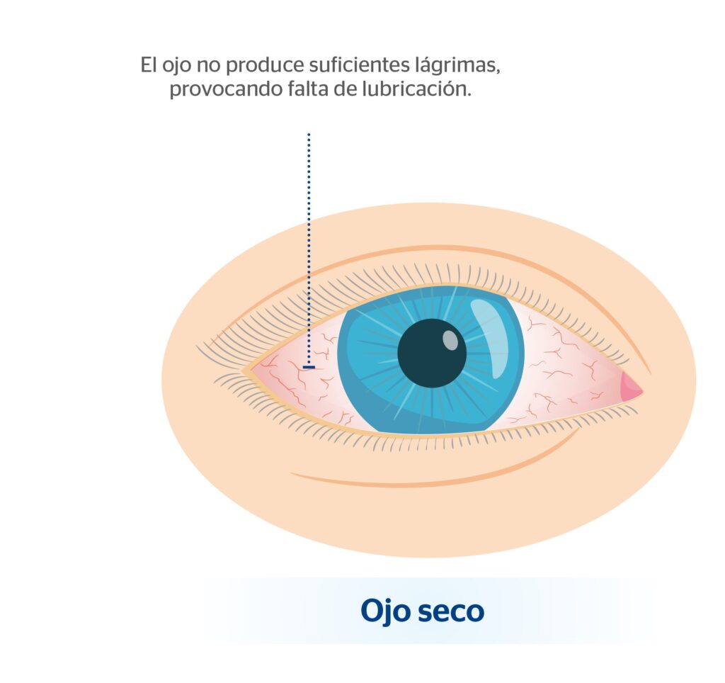 Descubre por qué tus ojos arden como si estuvieras cansado