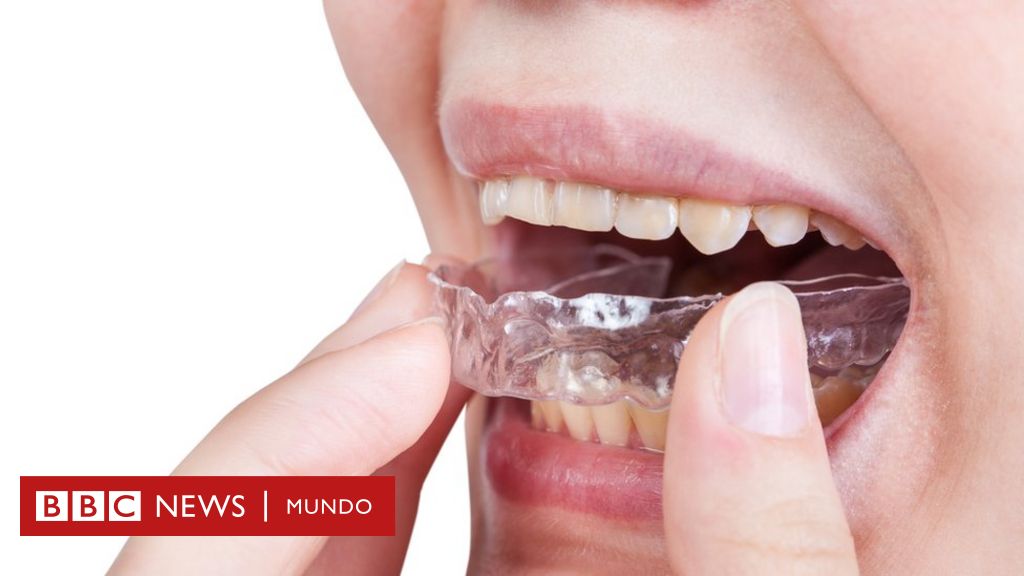 ¡Detén la pesadilla! Combate la caída de dientes mientras duermes