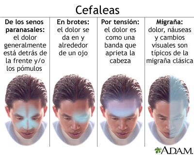 Dolor de cabeza izquierdo y fatiga: causas y soluciones