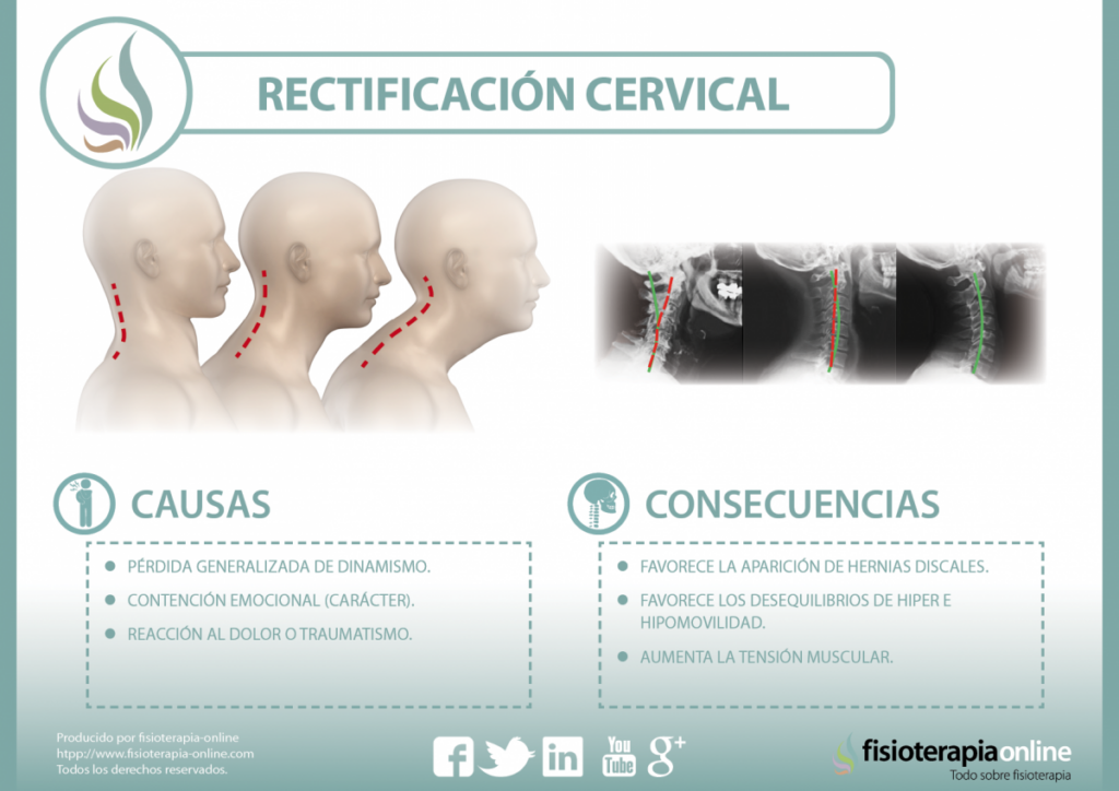 ¿Dolor de cuello y somnolencia? Descubre sus posibles causas