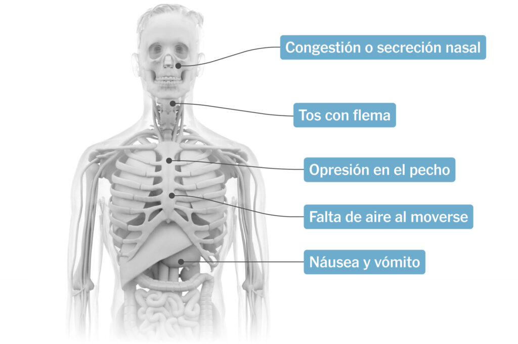 Dolor en pecho, cabeza, cadera y sueño: ¿Qué podría estar causándolo?