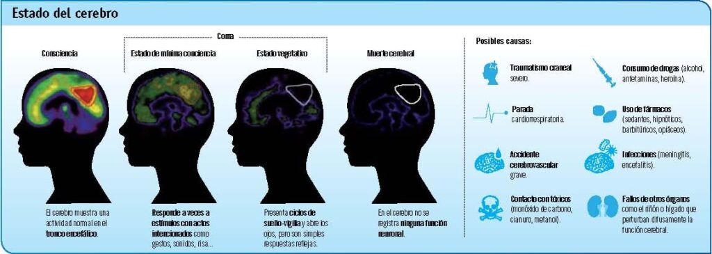 ¿Edad y sueño? Descubre cómo afecta el estado de conciencia