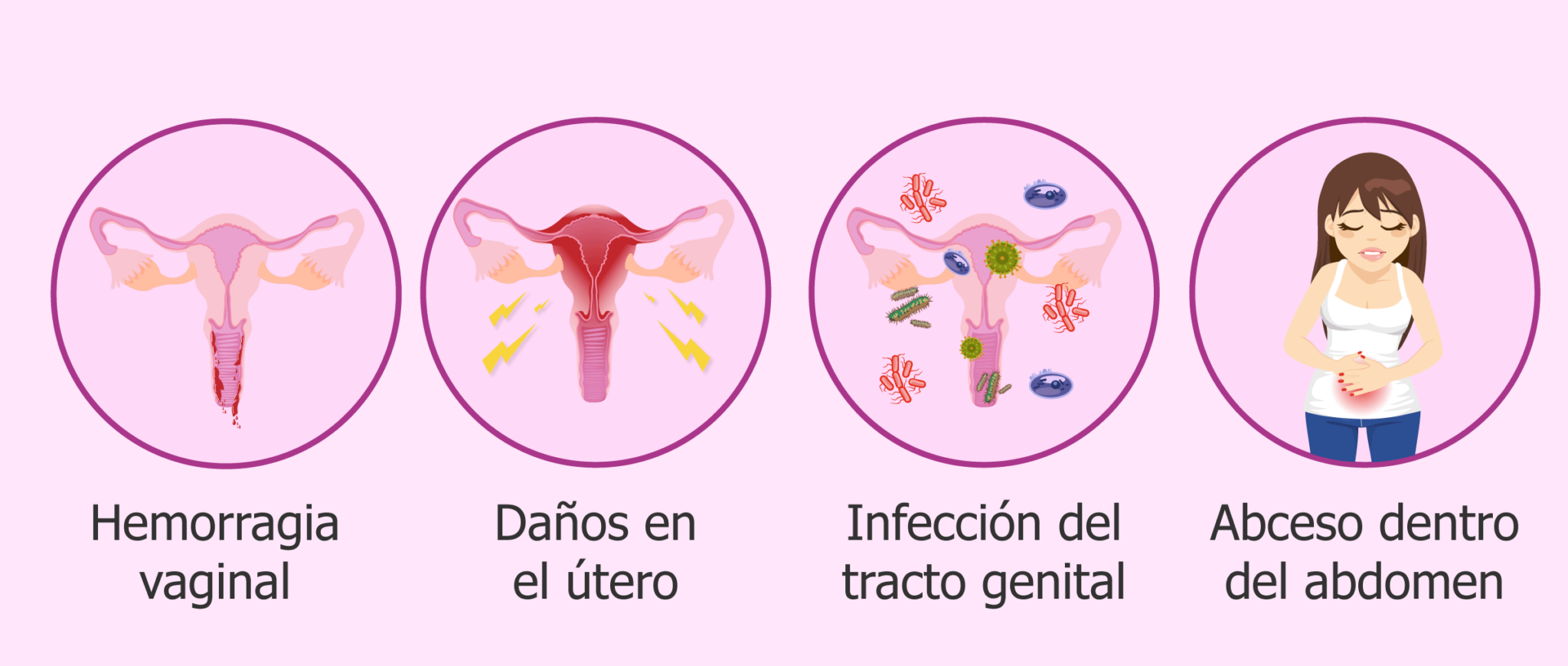 Embarazo Y Sueños De Aborto ¿qué Significan Descúbrelo Aquí 0721