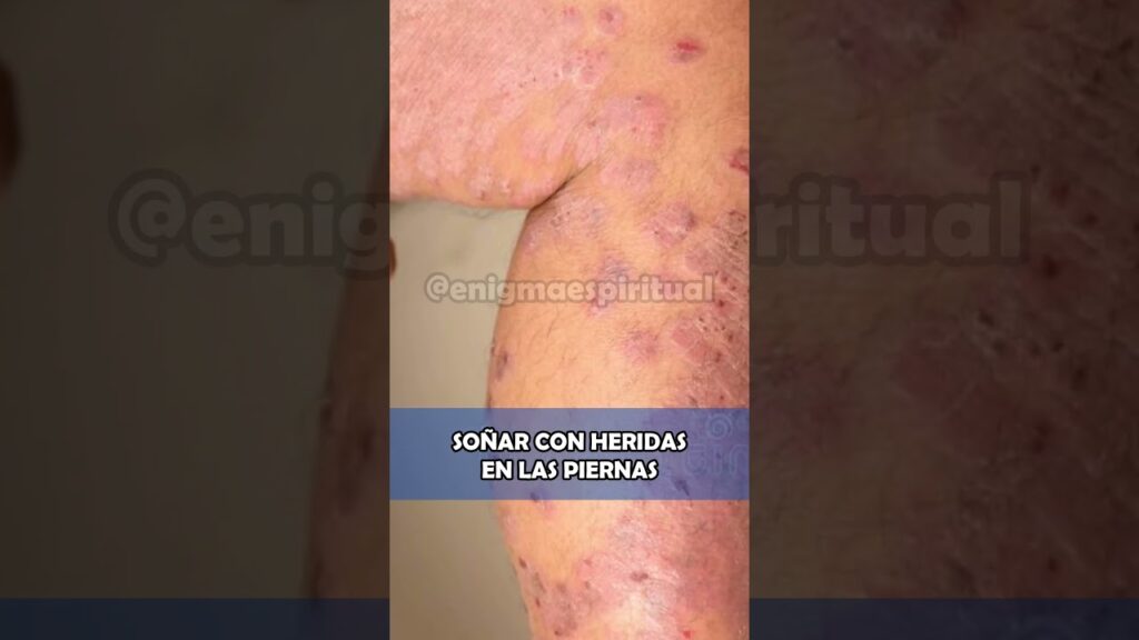 Interpretando el significado de soñar con heridas en las piernas de alguien más