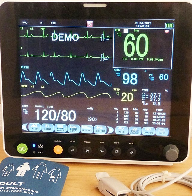 Monitoreo vital durante el sueño: Pulsioximetría hospitalaria