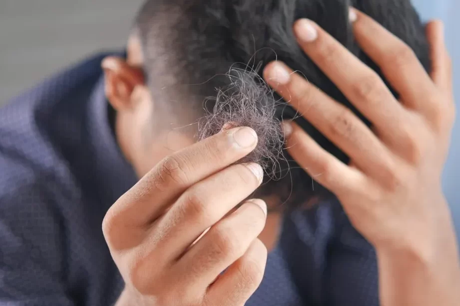 ¿Pesadilla o señal? Descubre qué significa soñar con perder cabello