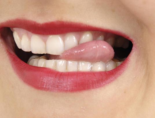 ¿Por qué sueñas con tus dientes cayendo? Descubre la respuesta