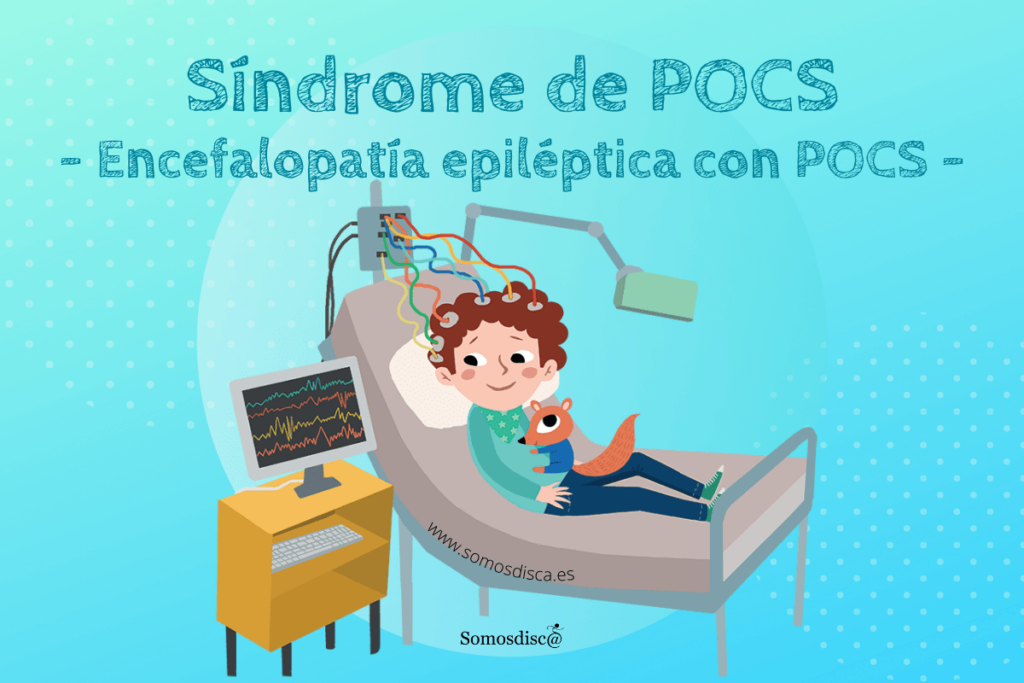 Síndromes epilépticos con punta-onda continua: causas y tratamientos