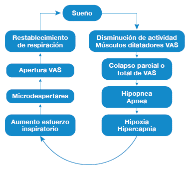 Síntomas del SAHOS: descubre el cuadro clínico