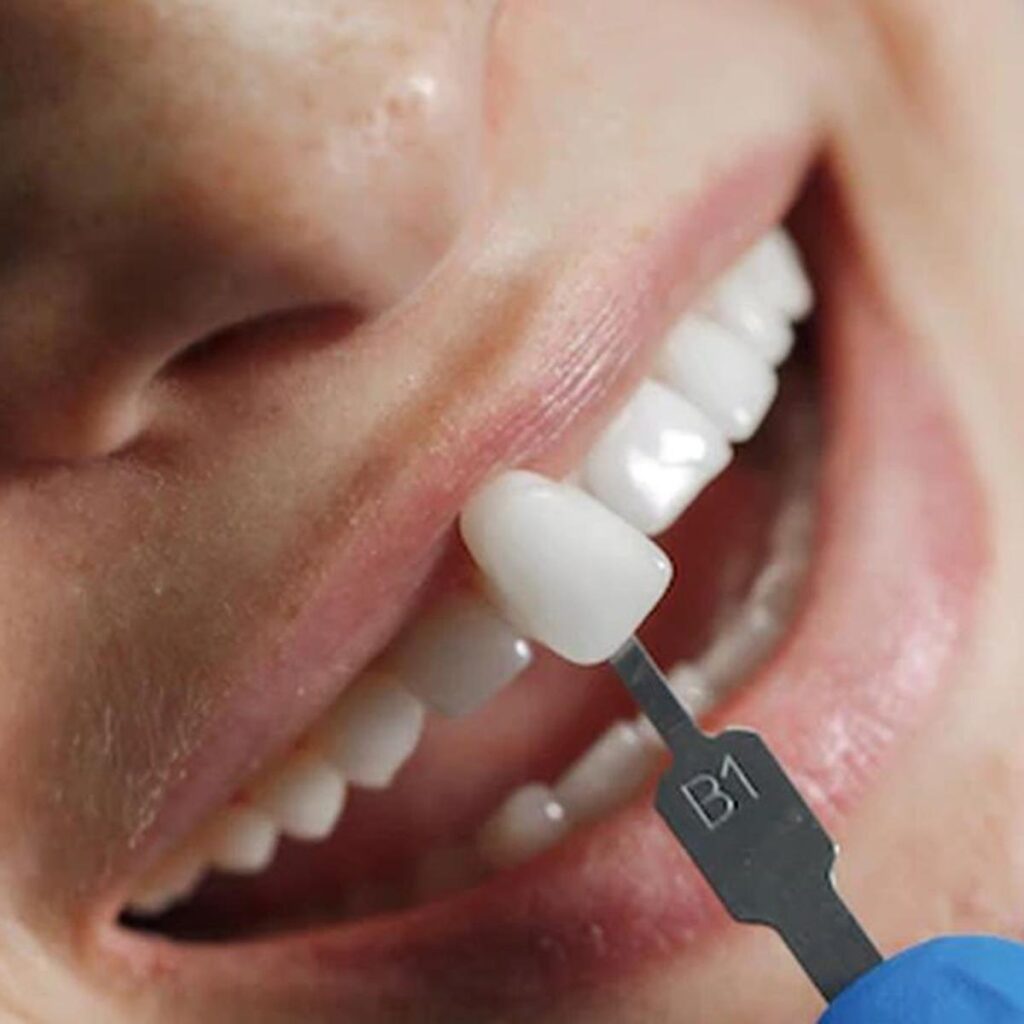 ¿Sueñas con perder tus dientes? Descubre por qué sucede