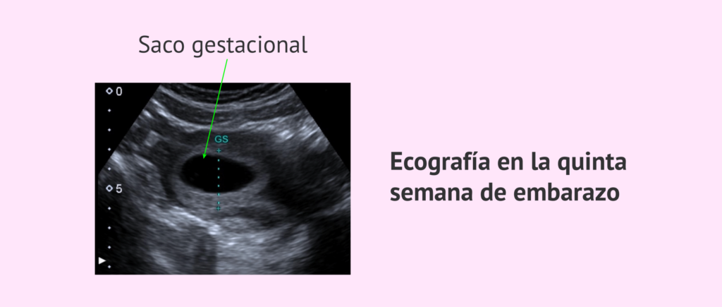 ¿Sueño en el embarazo? Descubre en qué semana aparece