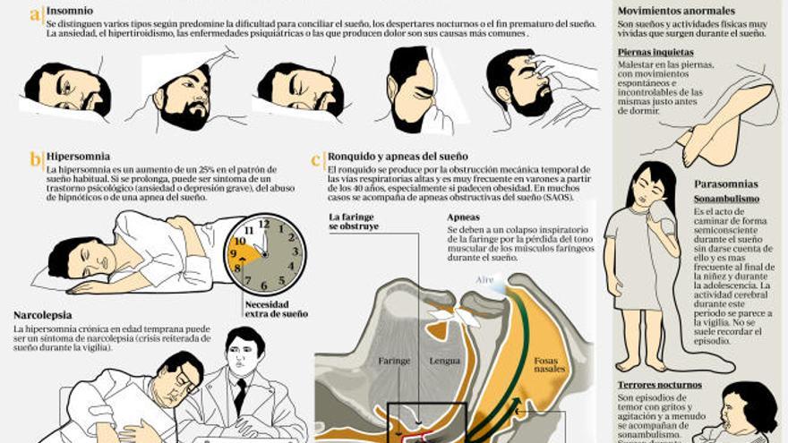 ¿Sufres de somnolencia diaria? Descubre qué es la hipersomnia