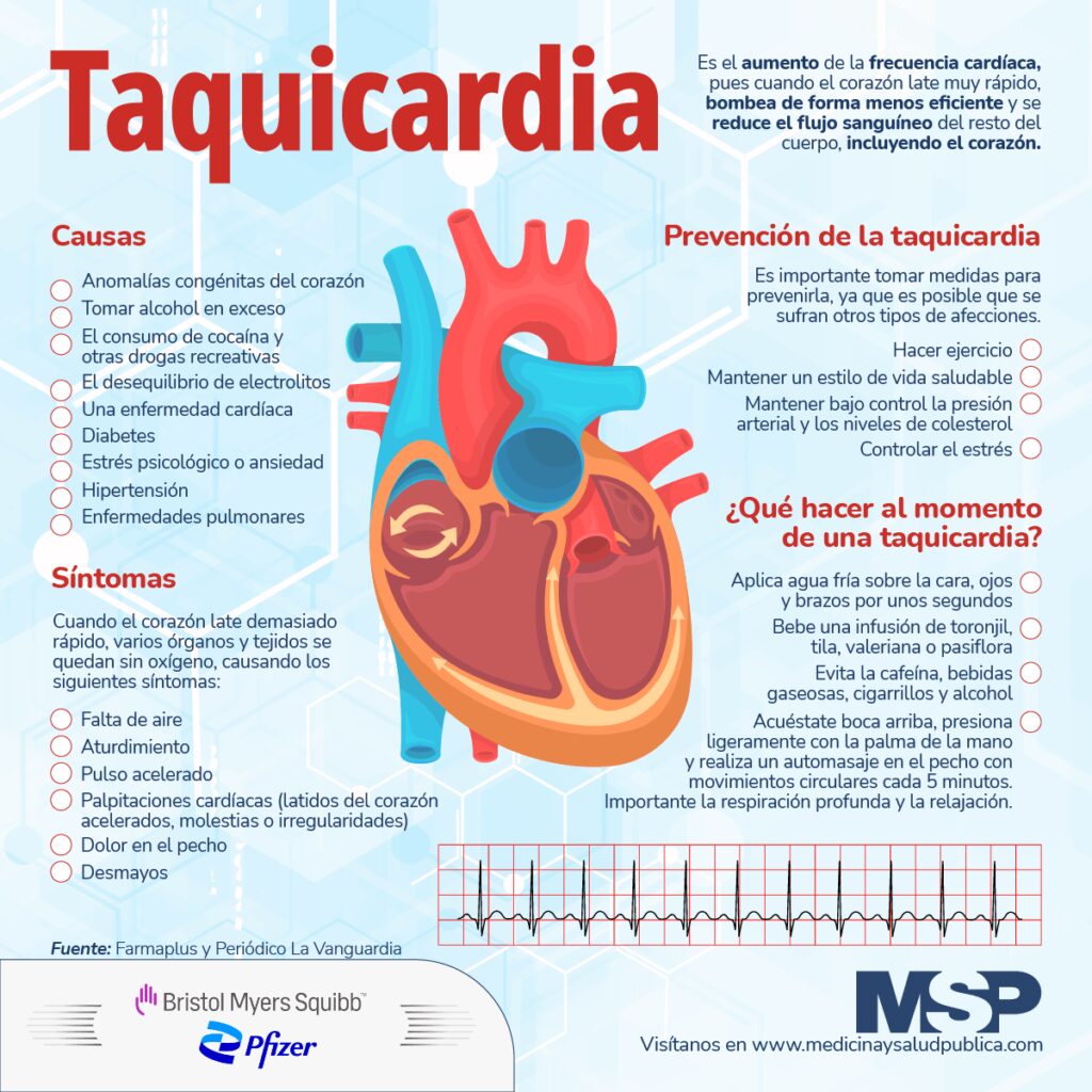 ¿Taquicardia y somnolencia? Descubre por qué ocurre