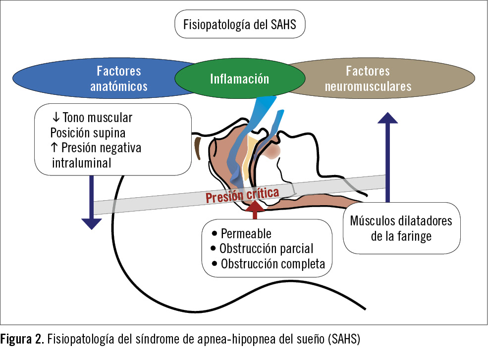 Terapia génica: del sueño a la realidad en un esquema